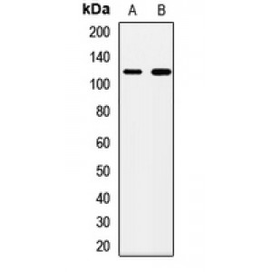 LifeSab™ PMPCA Rabbit pAb (50 µl)