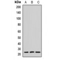 LifeSab™ MYL6B Rabbit pAb (50 µl)