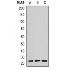 LifeSab™ MYL6B Rabbit pAb (50 µl)