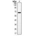 LifeSab™ RORA Rabbit pAb (50 µl)