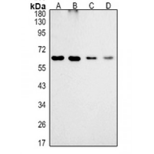 LifeSab™ MTMR9 Rabbit pAb (50 µl)