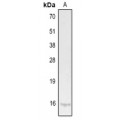 LifeSab™ IL-9 Rabbit pAb (50 µl)