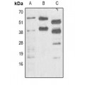 LifeSab™ Pik3r1 Mouse mAb (50 µl)