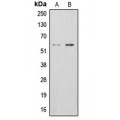 LifeSab™ ALDH1B1 Rabbit pAb (50 µl)