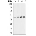 LifeSab™ ALDH3B2 Rabbit pAb (50 µl)