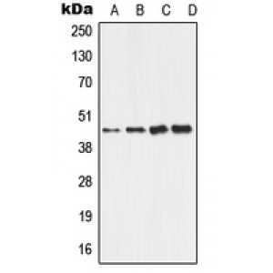 LifeSab™ ALDH3B2 Rabbit pAb (50 µl)