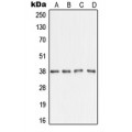 LifeSab™ AMD1 Rabbit pAb (50 µl)