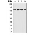 LifeSab™ AR (pY363) Rabbit pAb (50 µl)
