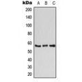 LifeSab™ ATP6V1B1 Rabbit pAb (50 µl)