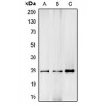 LifeSab™ C1R Rabbit pAb (50 µl)