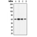 LifeSab™ CAMK2B Rabbit pAb (50 µl)