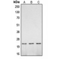LifeSab™ CASP2 p18 Rabbit pAb (50 µl)