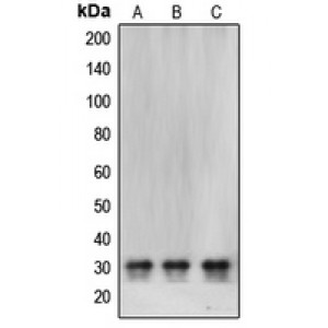LifeSab™ CBR1 Rabbit pAb (50 µl)