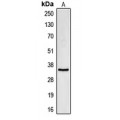 LifeSab™ CDC34 Rabbit pAb (50 µl)