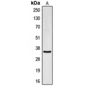 LifeSab™ CDC34 Rabbit pAb (50 µl)