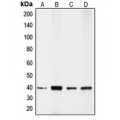 LifeSab™ CDX2 Rabbit pAb (50 µl)