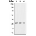 LifeSab™ G18 Rabbit pAb (50 µl)