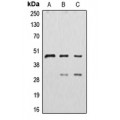 LifeSab™ CTSD Rabbit pAb (50 µl)