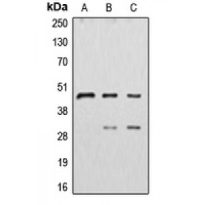 LifeSab™ CTSD Rabbit pAb (50 µl)