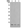 LifeSab™ CTSD LC Rabbit pAb (50 µl)