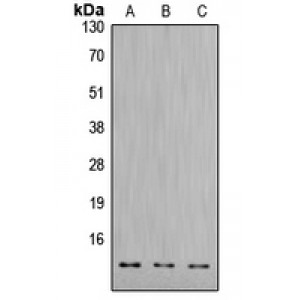 LifeSab™ CTSD LC Rabbit pAb (50 µl)