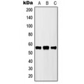 LifeSab™ CYP2D6 Rabbit pAb (50 µl)