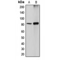 LifeSab™ DGKA Rabbit pAb (50 µl)
