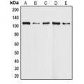 LifeSab™ DAXX Rabbit pAb (50 µl)