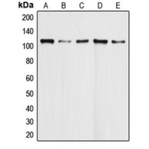LifeSab™ DAXX Rabbit pAb (50 µl)