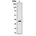 LifeSab™ CYB5R3 Rabbit pAb (50 µl)