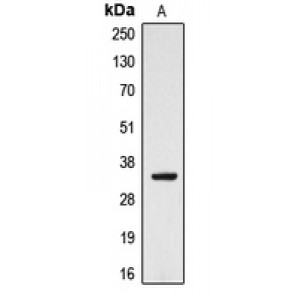 LifeSab™ CYB5R3 Rabbit pAb (50 µl)