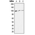 LifeSab™ DNM1 (pS774) Rabbit pAb (50 µl)
