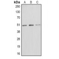 LifeSab™ E2F1 (pT433) Rabbit pAb (50 µl)