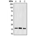 LifeSab™ EFNA2 Rabbit pAb (50 µl)