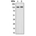 LifeSab™ EPHA2 (pY588) Rabbit pAb (50 µl)