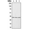 LifeSab™ HUR Rabbit pAb (50 µl)