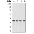 LifeSab™ FHL2 Rabbit pAb (50 µl)