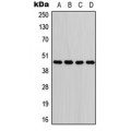 LifeSab™ GOT1 Rabbit pAb (50 µl)