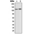 LifeSab™ mGLUR2 Rabbit pAb (50 µl)