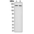 LifeSab™ MSH6 Rabbit pAb (50 µl)