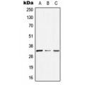 LifeSab™ GTF2E2 Rabbit pAb (50 µl)