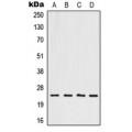LifeSab™ HOXB7 Rabbit pAb (50 µl)