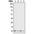 LifeSab™ ID1 Rabbit pAb (50 µl)