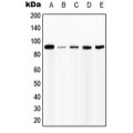 LifeSab™ IFNGR1 (pY457) Rabbit pAb (50 µl)