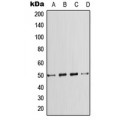 LifeSab™ SMAD7 Rabbit pAb (50 µl)