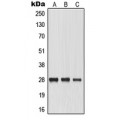 LifeSab™ MIP Rabbit pAb (50 µl)