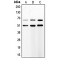 LifeSab™ MMP8 Rabbit pAb (50 µl)