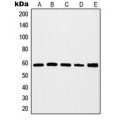 LifeSab™ c-Myc Rabbit pAb (50 µl)