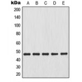 LifeSab™ NFKBIB Rabbit pAb (50 µl)