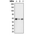 LifeSab™ PFKFB2 (pS483) Rabbit pAb (50 µl)